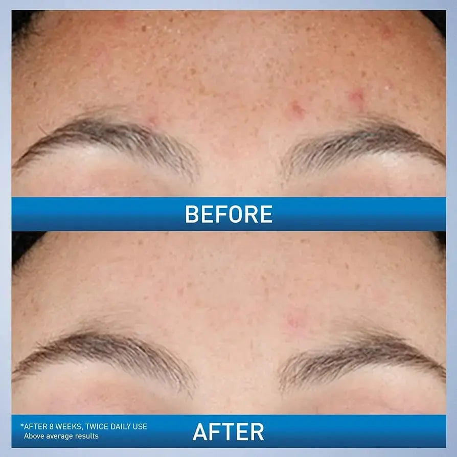 CeraVe Resurfacing Retinol Serum with Ceramides & Niacinamide – 30 ml The Nexa Pure