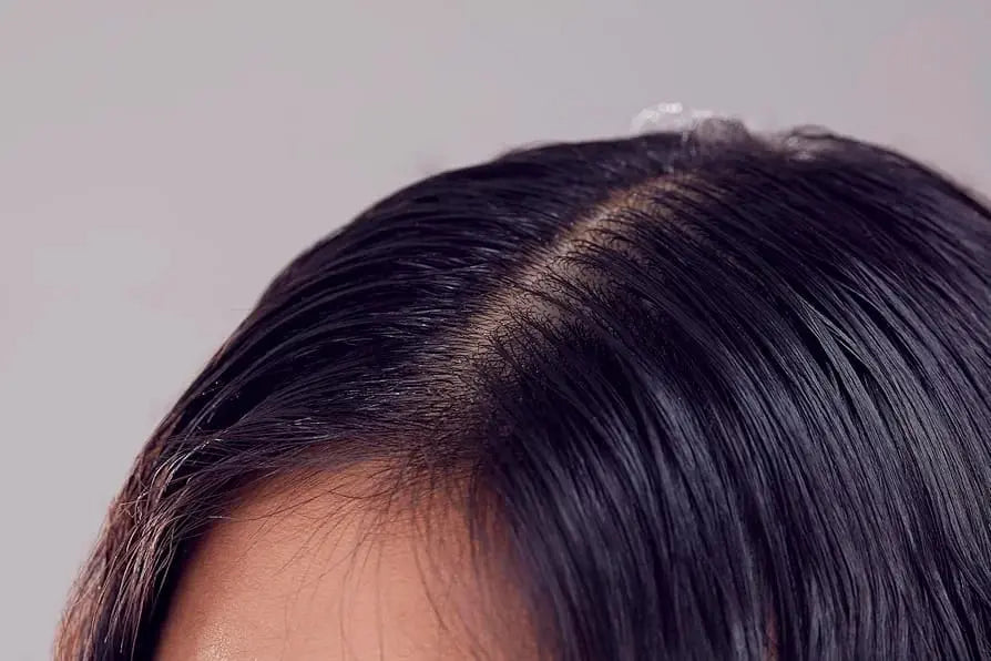 Hair Growth Serum – Intense Formula Nexa Pure
